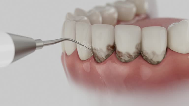 Trusted Root Canal Treatment service in Montezuma, IA - Dentist Open Now